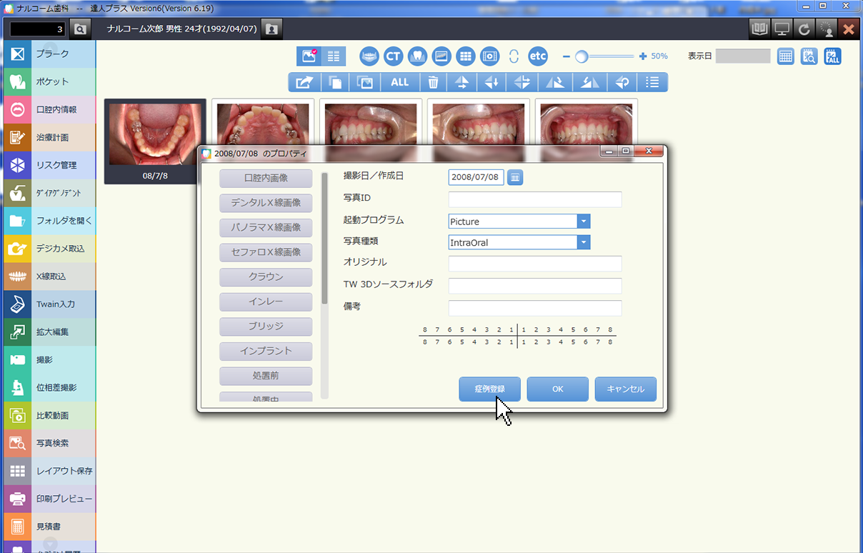 症例登録をクリック